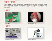 관절내시경 장비 